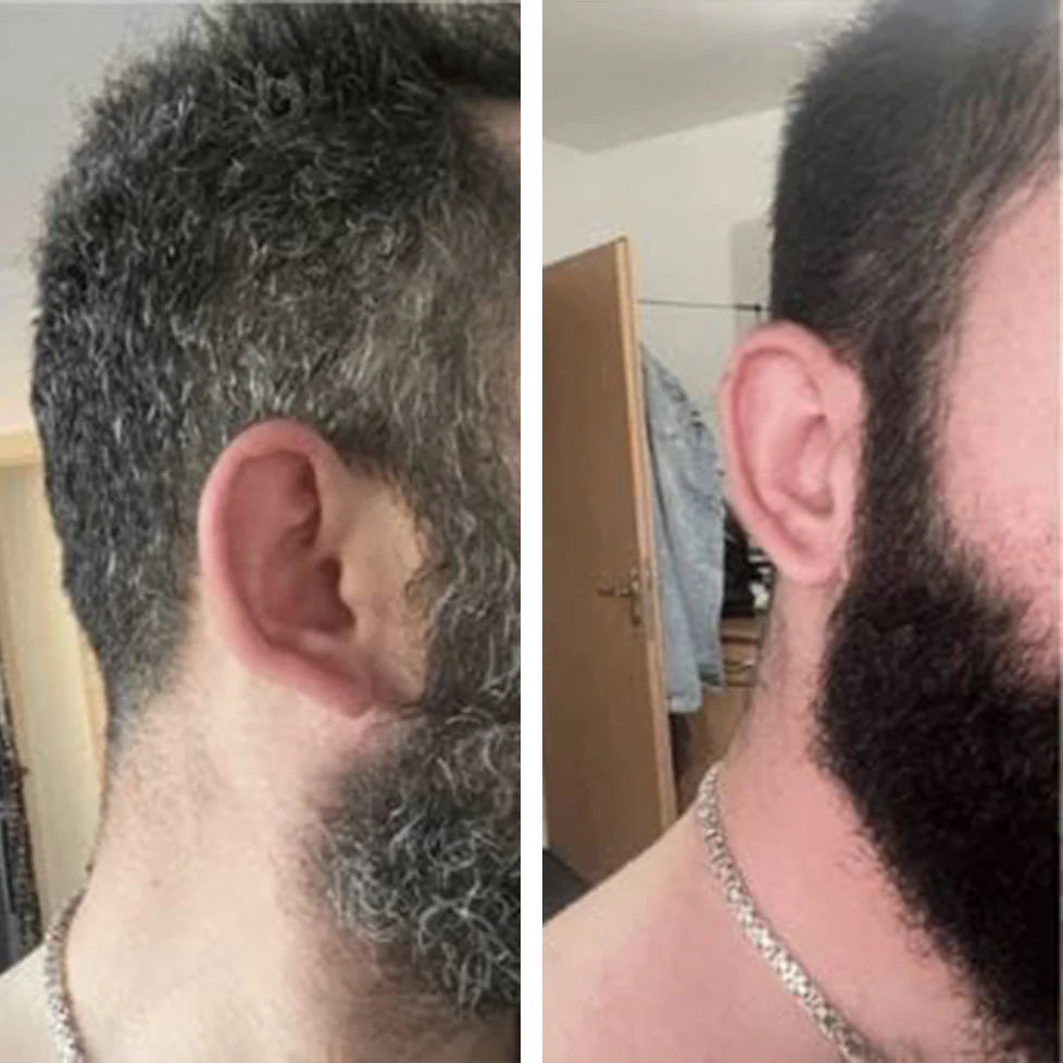 NOVAHAIR For Men